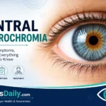 Central Heterochromia