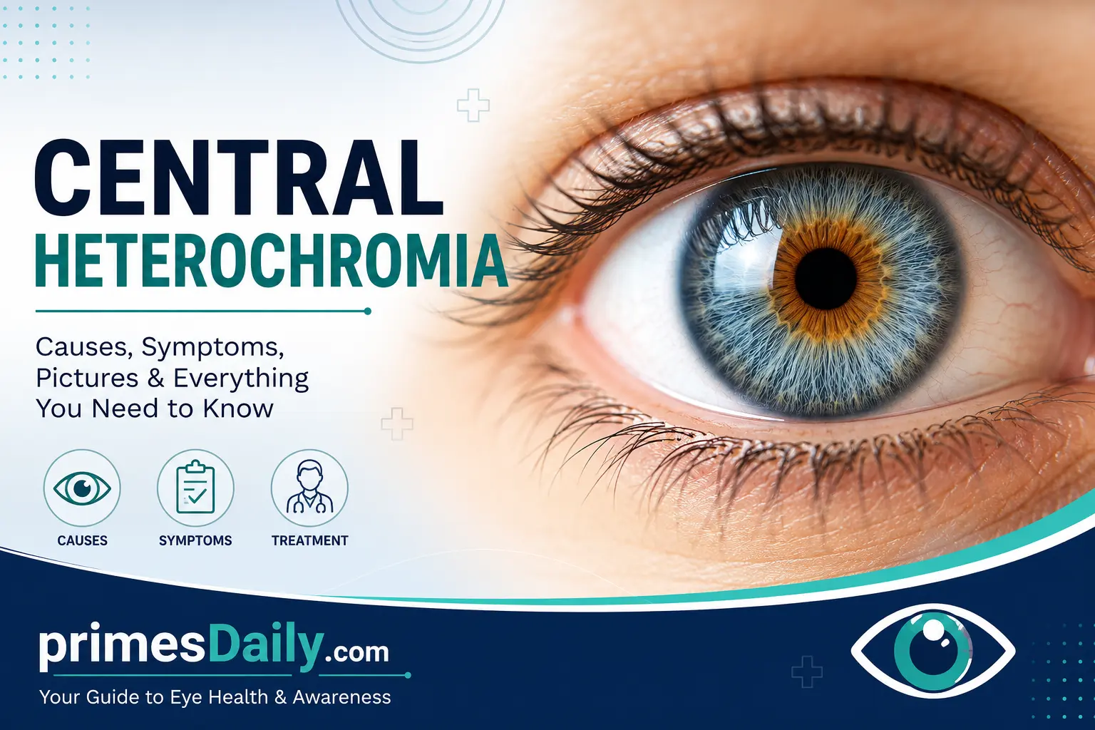 Central Heterochromia